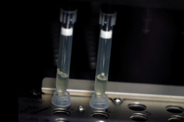 随着猴痘病例的增加，美国寻求扩大猴痘测试 